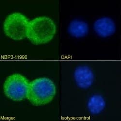TIM-4 Rabbit anti-Mouse, Clone: 3A1, Novus Biologicals 0.2 mg; Unconjugated:Antibodies,